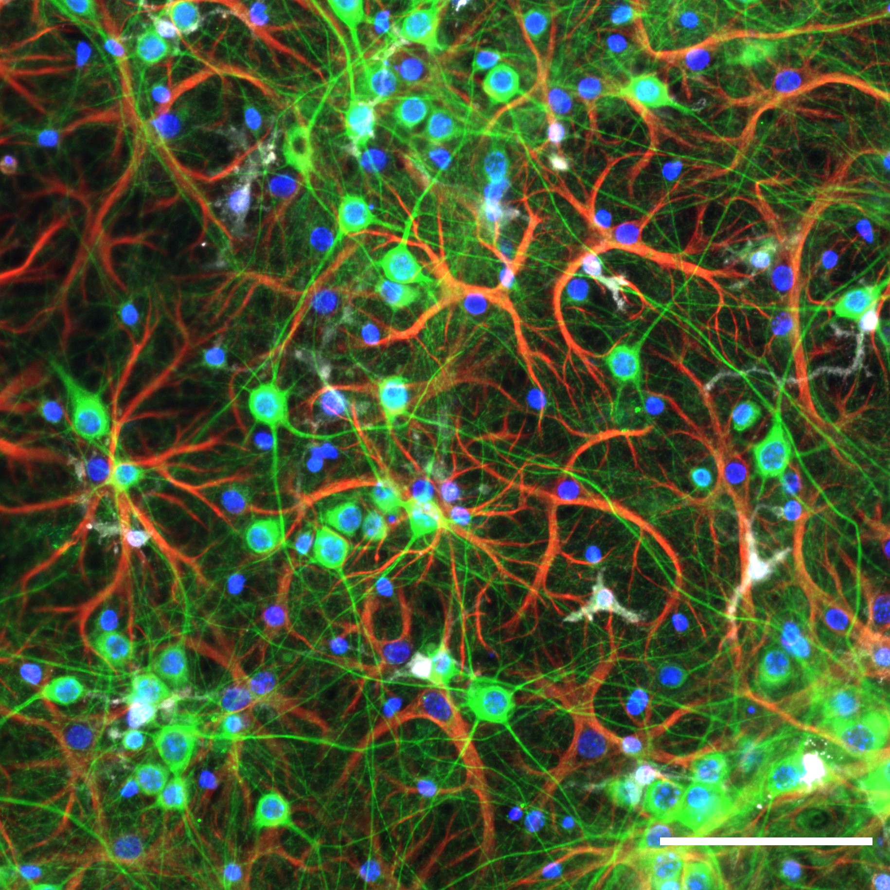 Neurons under fluorescence