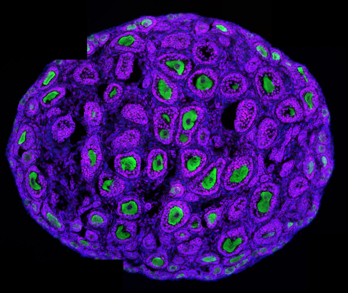 A mouse ovary with the eggs marked in green and the supporting cells in magenta